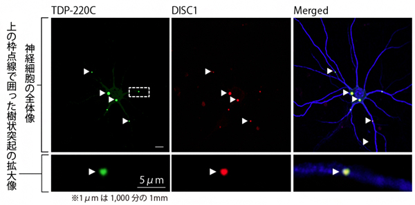 前頭側頭葉変性症(FTLD)モデル神経細胞におけるDISC1とTDP220Cの共凝集の図