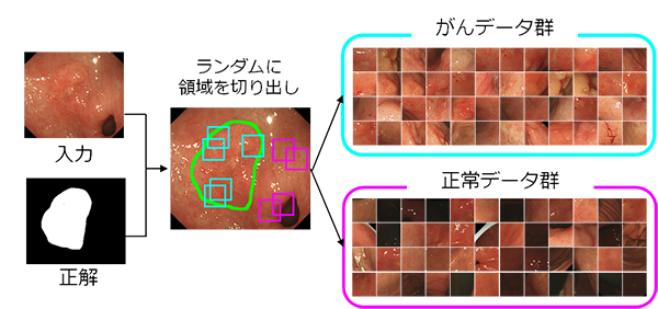 早期胃がんの正解画像からランダムに切り出した「がん」と「正常」の学習用画像の写真