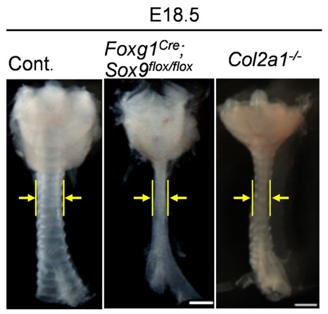 組織特異的Sox9遺伝子変異マウスとCollagen 2a1遺伝子変異マウスの気管狭窄形態の図