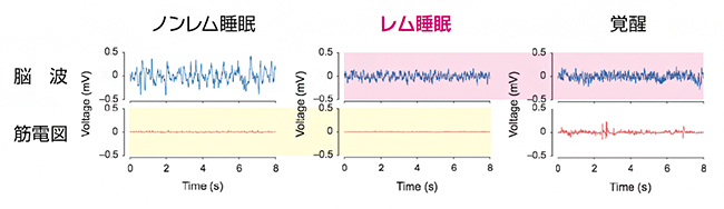 醒、レム睡眠、ノンレム睡眠時の脳波と筋電図の波形例の図