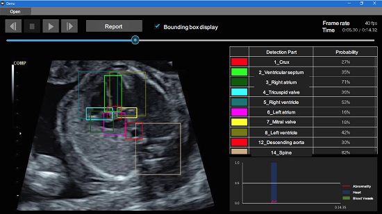 Screenshot of the screening system