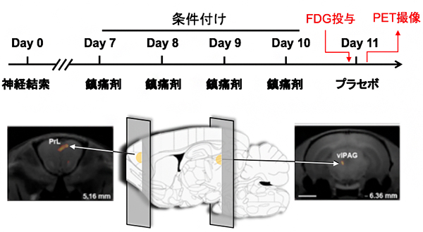 プラセボ効果に関わる脳領域の図