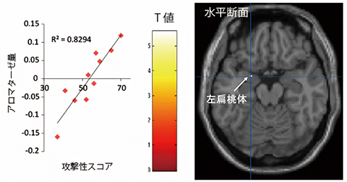 脳内アロマターゼ量と攻撃性に関連がある脳部位の図