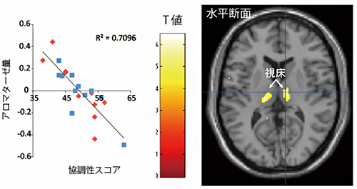 脳内アロマターゼ量と協調性に関連がある脳部位の図