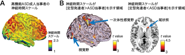 神経時間スケールの全脳分布と自閉スペクトラム症（ASD）成人当事者での特徴の写真