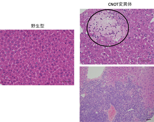 CNOT変異体マウスの肝臓で見られる壊死と炎症の図