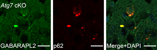 Atg7 欠損マウスの海馬の興奮性神経細胞におけるGABARAPL2とp62の共凝集の図