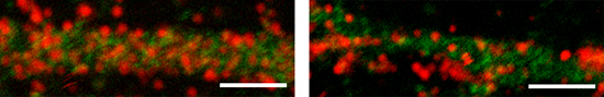 正常およびAtg7 欠損マウス脳の神経細胞における細胞表面のGABAA受容体の減少の図