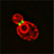 出芽酵母の分裂時に、セプチン（緑）によって分断された小胞体（赤）の図