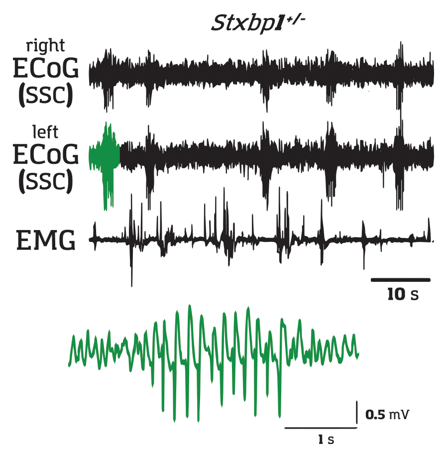 spike wave discharges seen on ECoGs