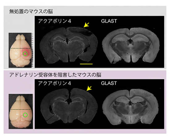 脳梗塞3時間後のアクアポリン4分布の可視化の図