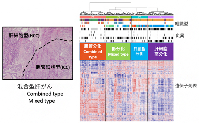 新たな肝がんの分子分類とその特性の図