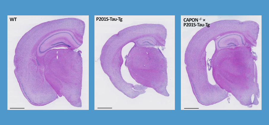 CAPON deficiency in AD mice