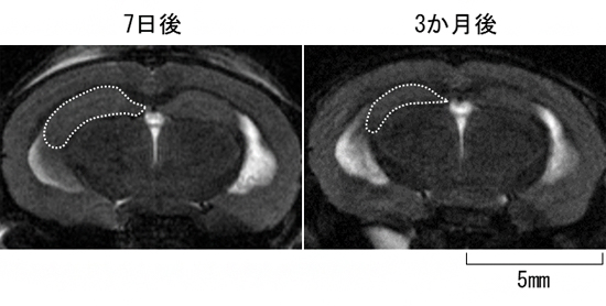 CAPON過剰発現マウス脳のMRI画像の図