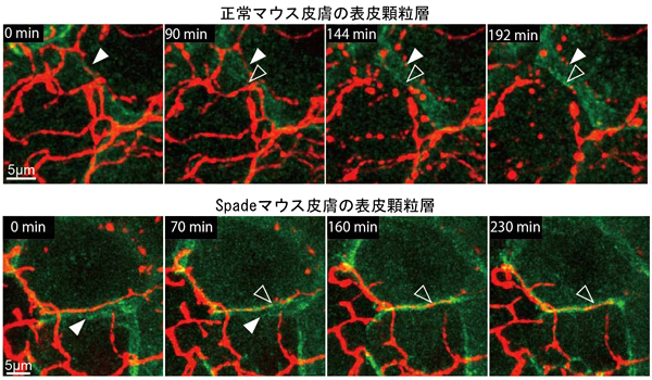 表皮顆粒層のTJ（緑）形成時の神経（赤）の剪定とそのSpadeマウスにおける異常の図