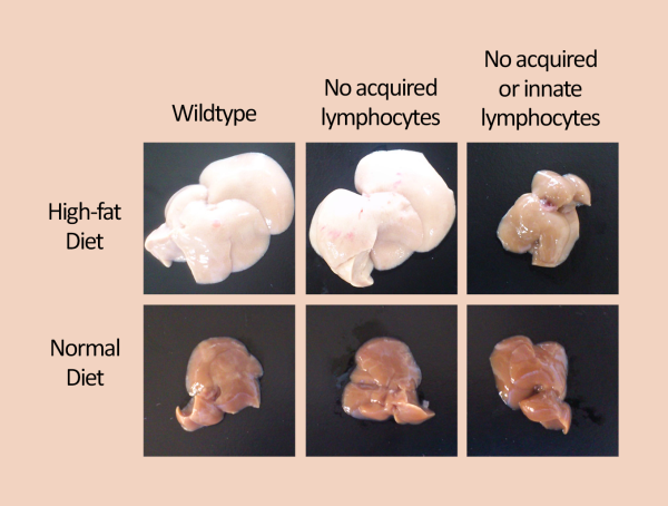 diet-induced obesity requires ILCs