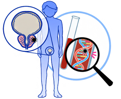 前立腺がんのゲノム医療の図