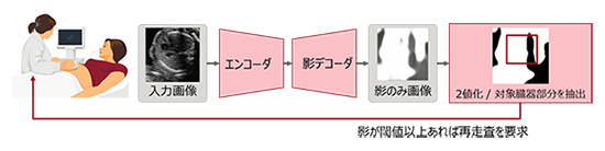 超音波検査画像の処理可否を判定する方法の例の図