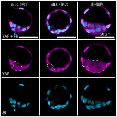 iBLCでの転写因子YAPの細胞内局在の図