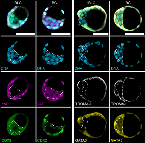 comparison iBLCs and BCs