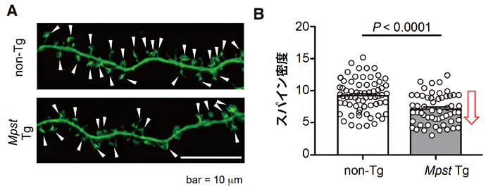 海馬初代神経培養細胞におけるスパインの画像と密度の図
