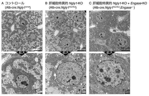 肝細胞特異的Ngly1-KO細胞の細胞核の形態異常の図