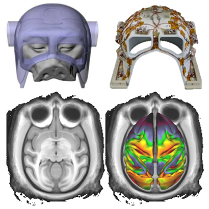 中型霊長類頭部用の多チャンネル・ラジオ波受信装置（上）とMRI画像・皮質マップ（下）の図