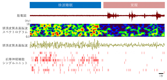 前障神経細胞のスパイク発火と大脳皮質脳波の図