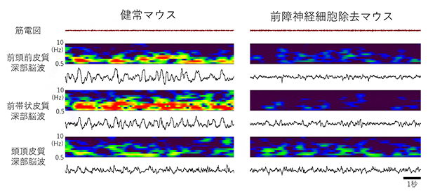 健常マウスと前障神経細胞除去マウスの前頭皮質における徐波活動の図