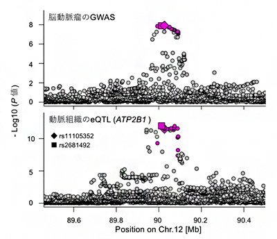 脳動脈瘤発症とATP2B1遺伝子の発現量の関連の図