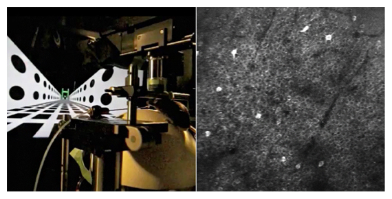 マウス用バーチャルリアリティシステムと海馬の細胞活動の顕微鏡画像の図