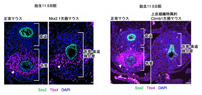 Nkx2.1欠損マウスおよび上皮組織特異的にWntシグナルを欠損させたマウスにおける気管間充織でのTbx4遺伝子の発現の図