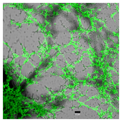 網目状のマイクロフィブリルの蛍光顕微鏡像の図