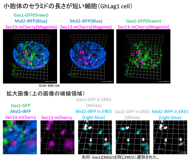 小胞体のセラミドの長さが短い細胞のGas1とMid2の小胞体局在とERESへ選別輸送の図