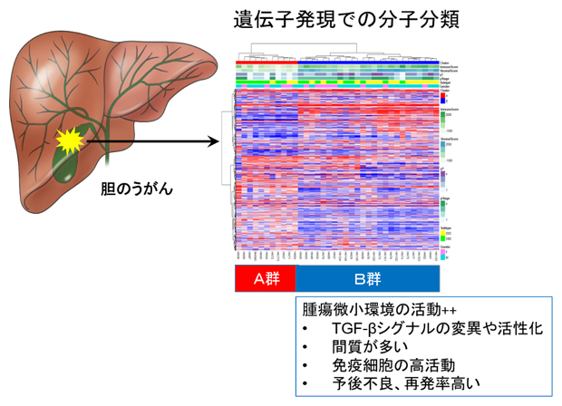 胆のうがんの遺伝子発現解析から明らかになった分子分類の図