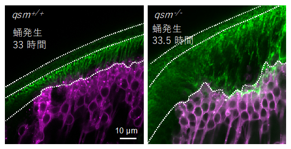 qsm変異体におけるDumpy線維の異常の図