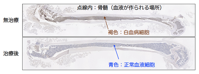 無治療と最適治療後（IAP阻害剤＋BCL2阻害剤）の白血病ヒト化マウスの骨の図