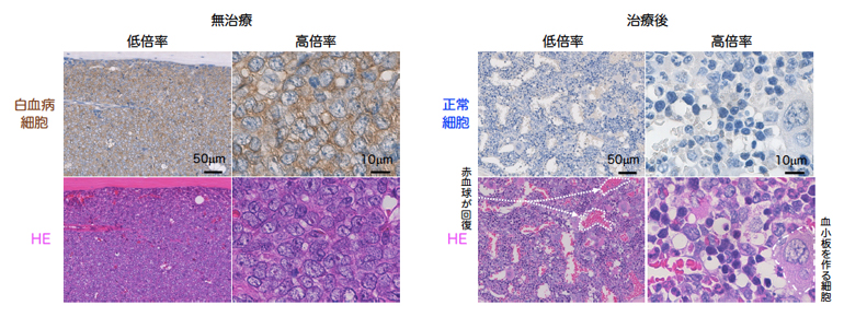 無治療と治療後(IAP阻害剤+BCL2阻害剤)の白血病ヒト化マウスの骨の顕微鏡の写真