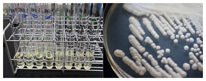 ブドウ糖・果糖の発酵能力試験の様子（左）と寒天培地上の酵母の図