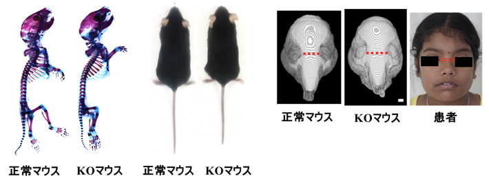 Tmem3ノックアウト（KO）マウスの表現型の図