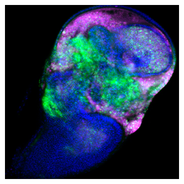 がん遺伝子Srcを発現する細胞は、増殖しつつ（緑）、死ぬ（赤紫）ことが明らかになったの図