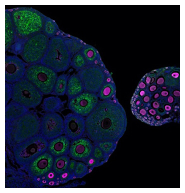 Wntシグナルが機能しない卵巣(右)は、原始卵胞が活性化せず不妊を引き起こすの図