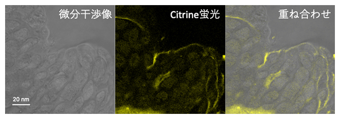 CPP-PICsomeに内包したCitrineタンパク質の細胞内局在の図