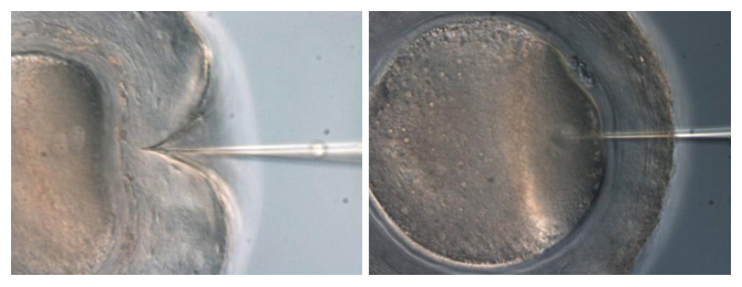 前核期受精卵へのマイクロインジェクションの図