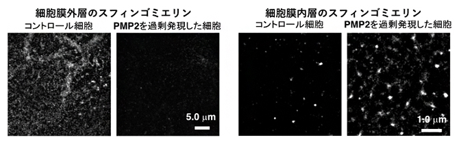 細胞膜外層のスフィンゴミエリンと内層のスフィンゴミエリンの図