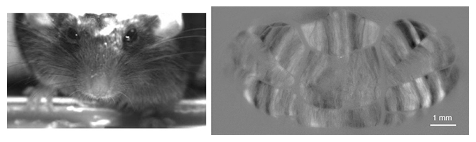 覚醒したマウス（左）小脳の背側全域に含まれる2万個以上のプルキンエ細胞の活動の図