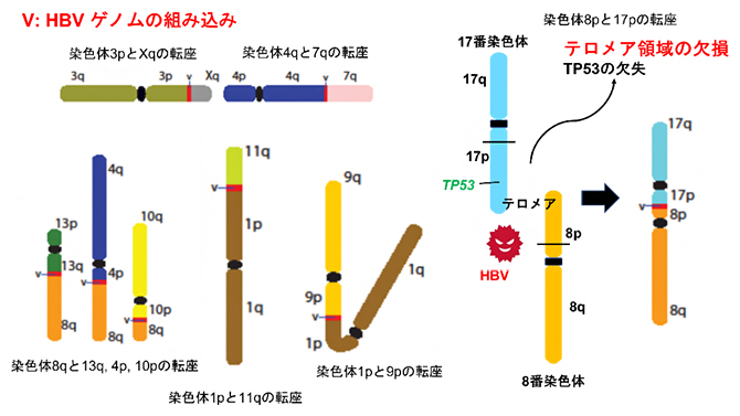 HBV組み込みを介した肝臓がんの染色体転座とテロメア領域の欠損の図