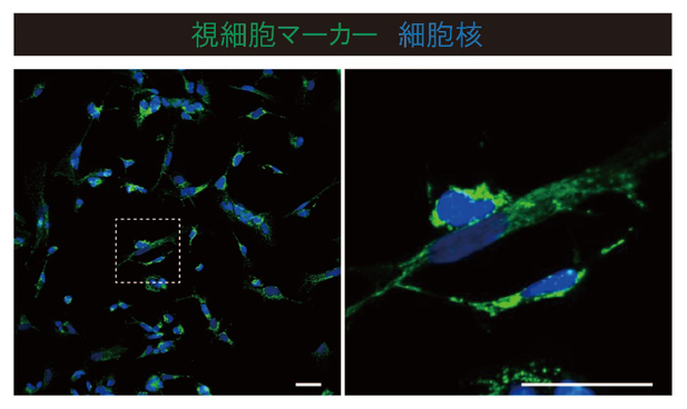 ヒトiPS細胞からの誘導視細胞の免疫染色画像の図