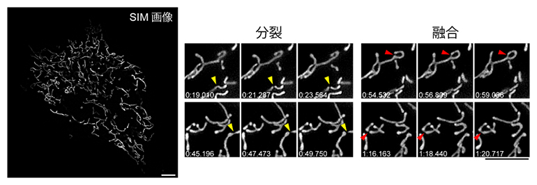 ミトコンドリアの分裂と融合の観察の図