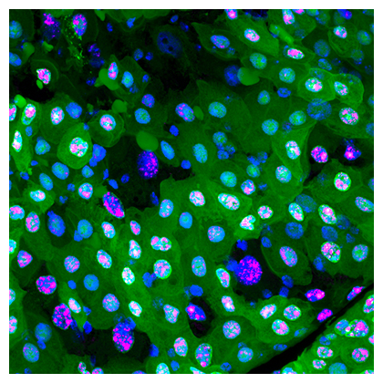 緑や赤の蛍光タンパク質がなくなった黒い細胞がエレボーシス（暗黒の細胞死）を起こしているの図